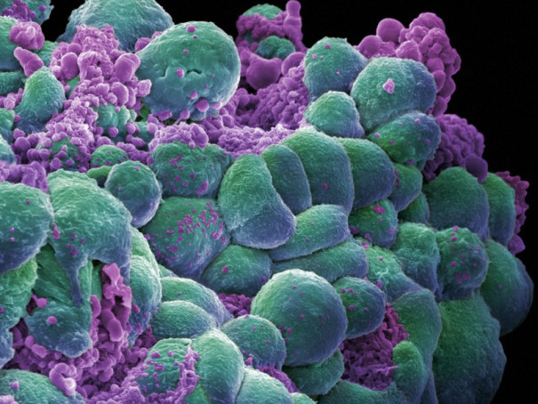 Учёные планируют сражаться с раком с помощью тепловых «нано-гранат»