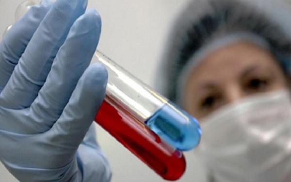 В российской столице в первый раз за 5 лет зафиксирована смерть от свиного гриппа