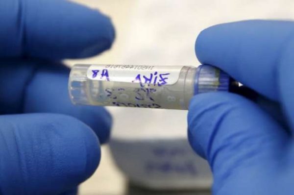 Ученые разработали быстрый и доступный тест на определение вируса Зика