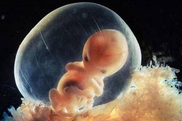 В Нидерландах будут растить опытные эмбрионы человека