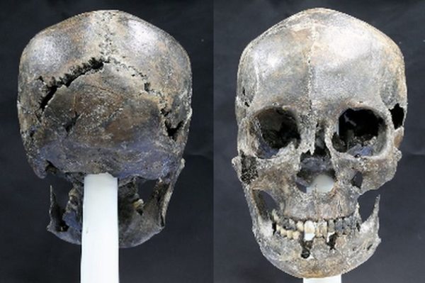Женский череп своеобразной формы был найден в Южной Корее