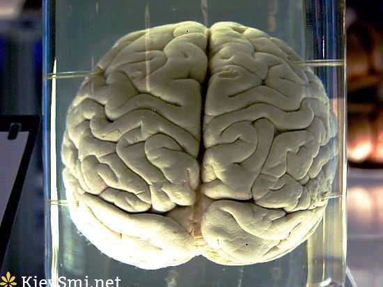 Нейробиологи составили первую подробную карту коры головного мозга