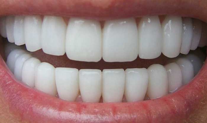Зубы могут рассказать о причине смерти