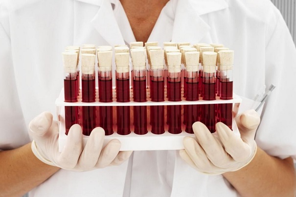 У людей найдены новые группы крови — Ученые