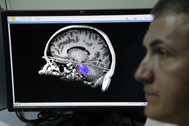 Людей с психологическими недугами призывают жертвовать мозг науке после смерти