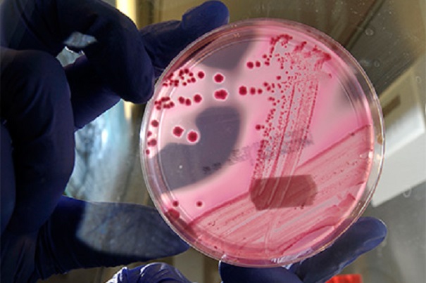 ВОЗ разрабатывает список новых смертельно рискованных бактерий, устойчивых к антибиотикам
