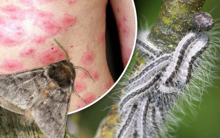 Жители Великобритании атакованы ядовитыми насекомыми