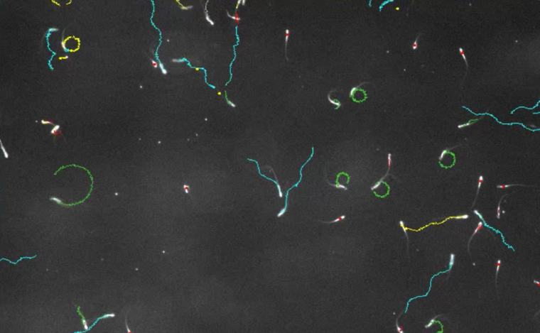 Коварные сперматозоиды `` травят '' своих соперников, заставляя их плавать кругами, пока они не умрут