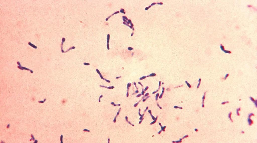 Дифтерия в первую очередь вызывается бактерией Corynebacterium diphtheriae.