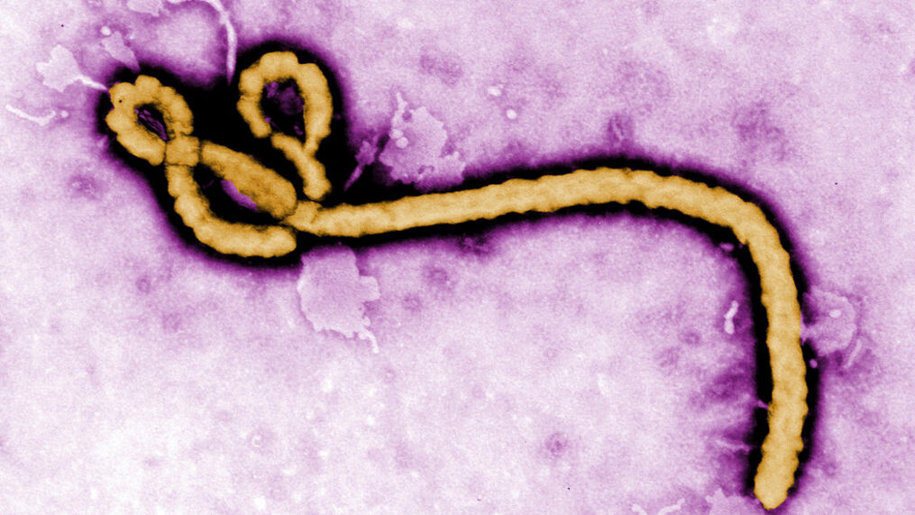 Вспышка Эболы в США, Вспышка Эболы в США, Возможная вспышка Эболы в США