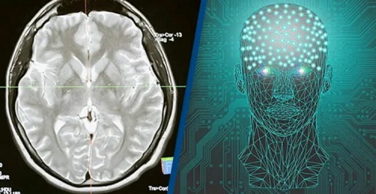 Учёные подключили человеческий мозг к компьютеру по беспроводной сети