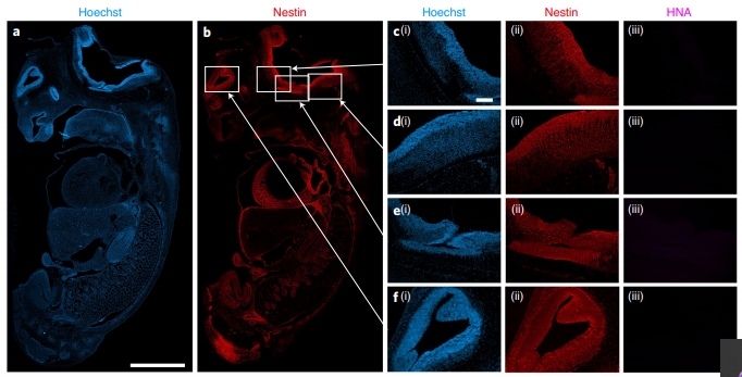 Нервная ткань эмбриона свиньи (красный цвет) не содержит человеческих клеток (фиолетовый цвет). Предоставлено: Maeng et al. / Природа и биомедицинская инженерия, 2021 г.