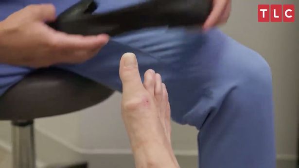 Женщина с «чрезвычайно редкими» сверхдлинными пальцами ног сбивает врачей с толку!