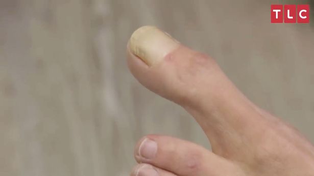 Женщина с «чрезвычайно редкими» сверхдлинными пальцами ног сбивает врачей с толку!