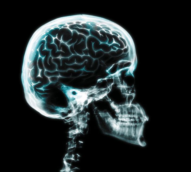 Исследователи просканировали мозг 746 взрослых тсиманэ в возрасте от 40 до 94 лет.