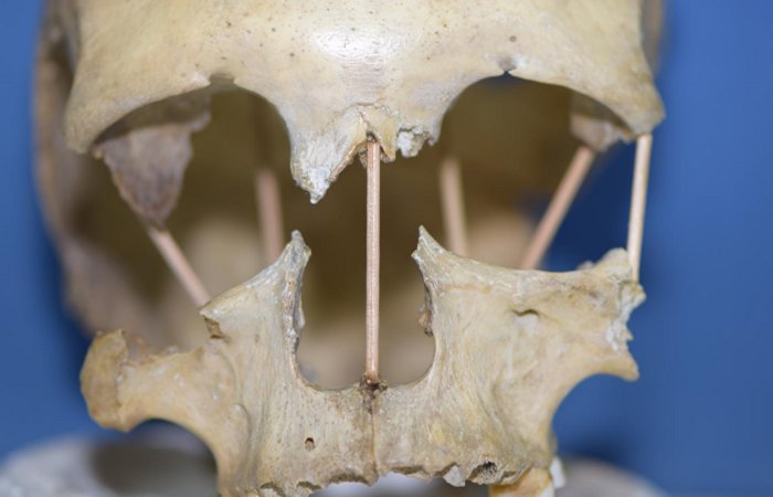 ДНК румынского черепа 35000-летней давности проливает новый свет на теорию эволюции