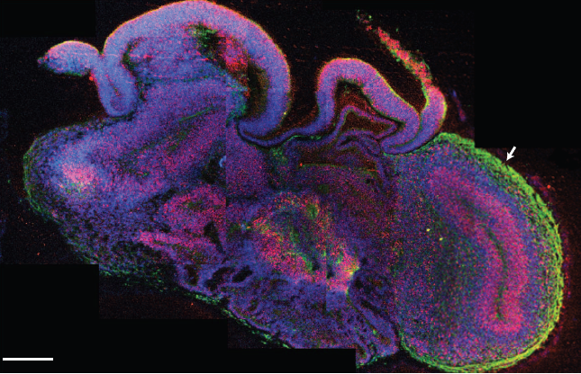 Срез органоида головного мозга с различными срезами, окрашенными с помощью иммуногистохимии на маркеры нейронов (зеленый) и клеток-предшественников (красный). Предоставлено: Мэдлин А. Ланкастер и др. / Nature 2013.