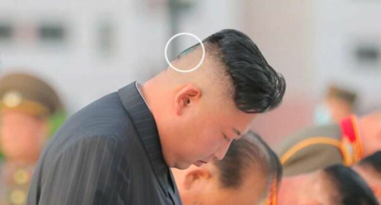 У Ким Чен Ына повязка и зеленое пятно на голове