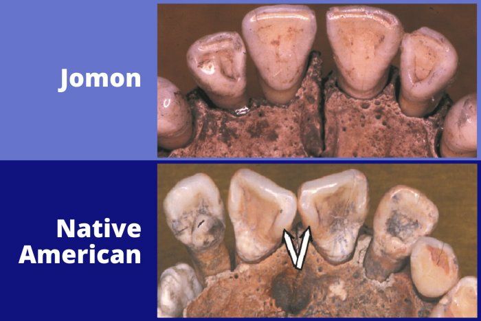 Зубы Джомона против зубов коренных американцев. Предоставлено: Дж. Ричард Скотт, Университет Невады, Рино.