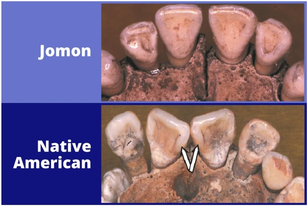Сравнение зубов Джомона и коренных американцев. Предоставлено: Г. Ричард Скотт.