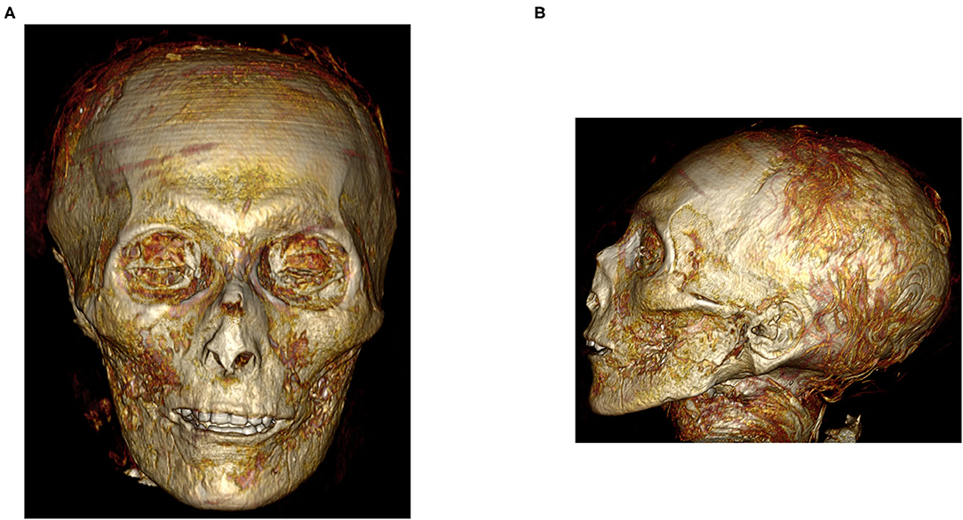 Трехмерный вид мумии Аменхотепа I в цифровой форме. Авторы и права: Сахар Салим и Захи Хавасс / Frontiers in Medicine, 2021 г.