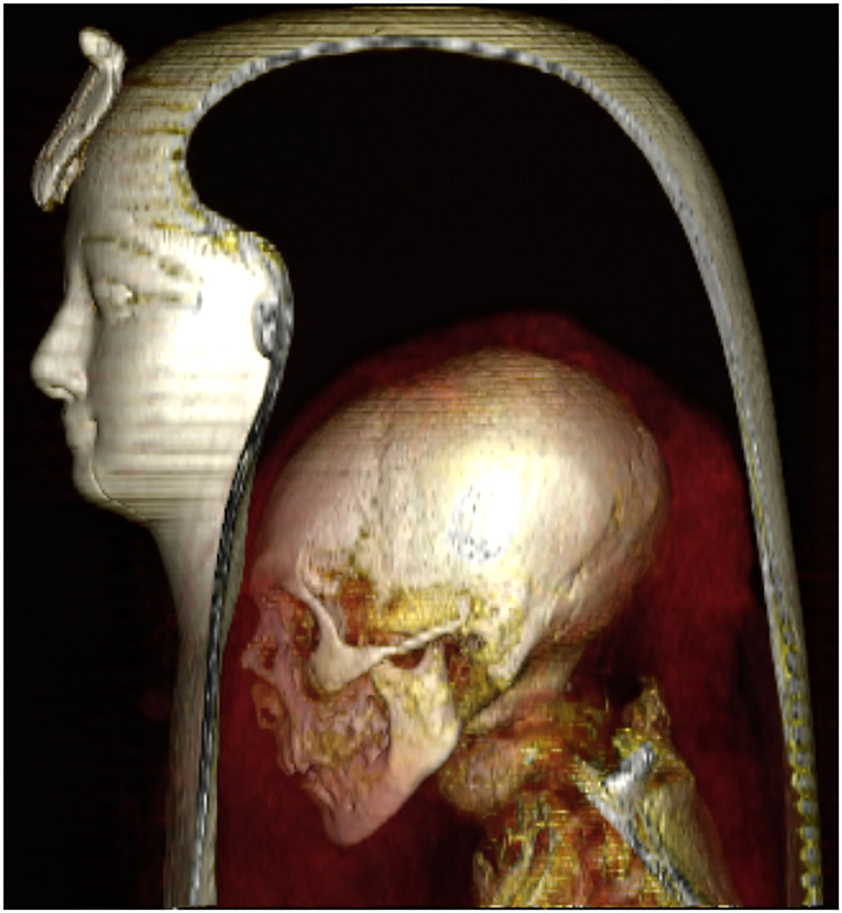 3D КТ изображение головы мумии. Предоставлено: Сахар Салим и Захи Хавасс / Frontiers in Medicine, 2021 г.
