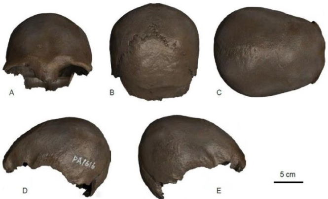 Нашли один из древнейших искусственно деформированных черепов