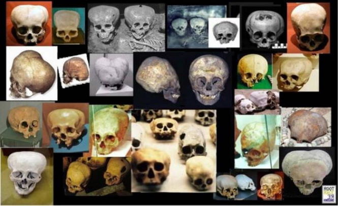 История удлиненных черепов, отрицаемая учеными
