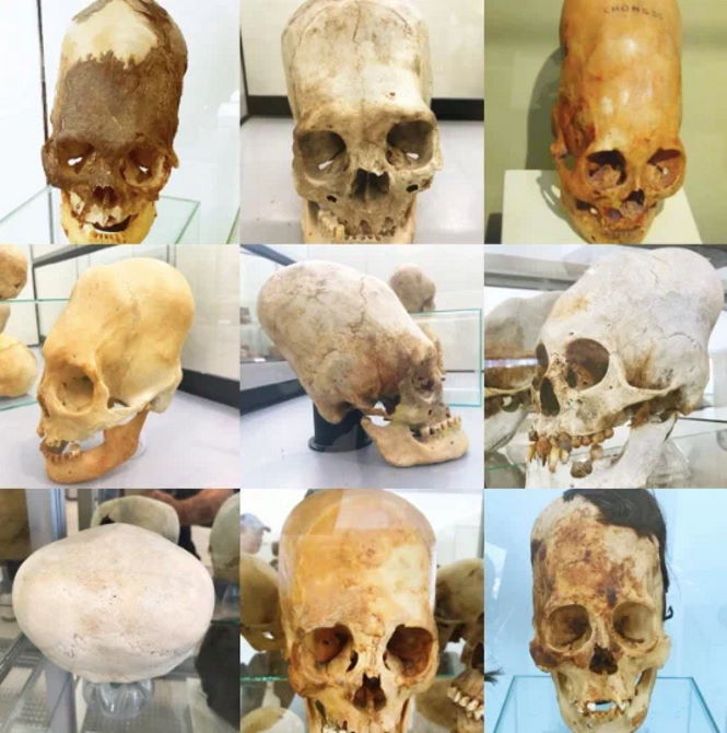 Откуда в Перу появились люди с удлинёнными черепами