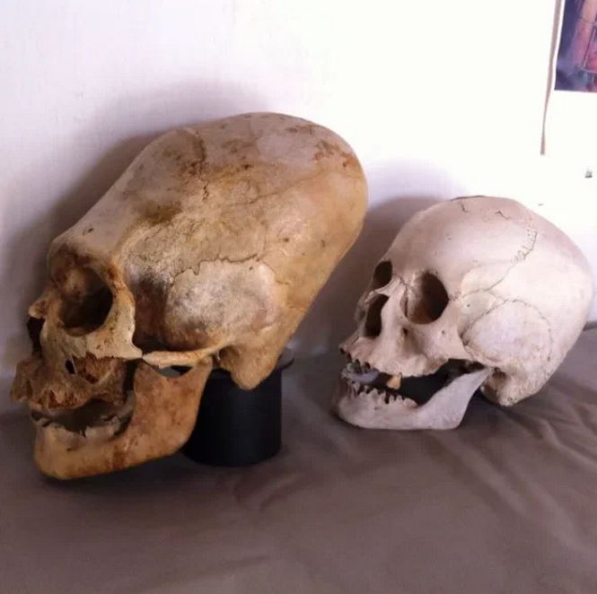 Откуда в Перу появились люди с удлинёнными черепами
