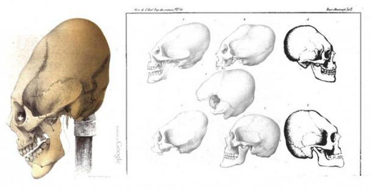 Удлиненные черепа еще не родившихся младенцев: Прощание с парадигмой искусственной деформации черепа