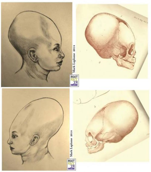 Удлиненные черепа еще не родившихся младенцев: Прощание с парадигмой искусственной деформации черепа