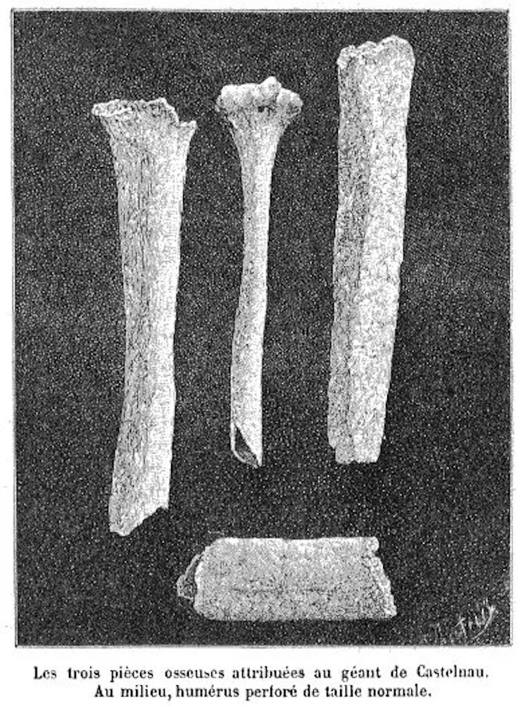 Загадка гигантских человеческих костей, найденных во Франции