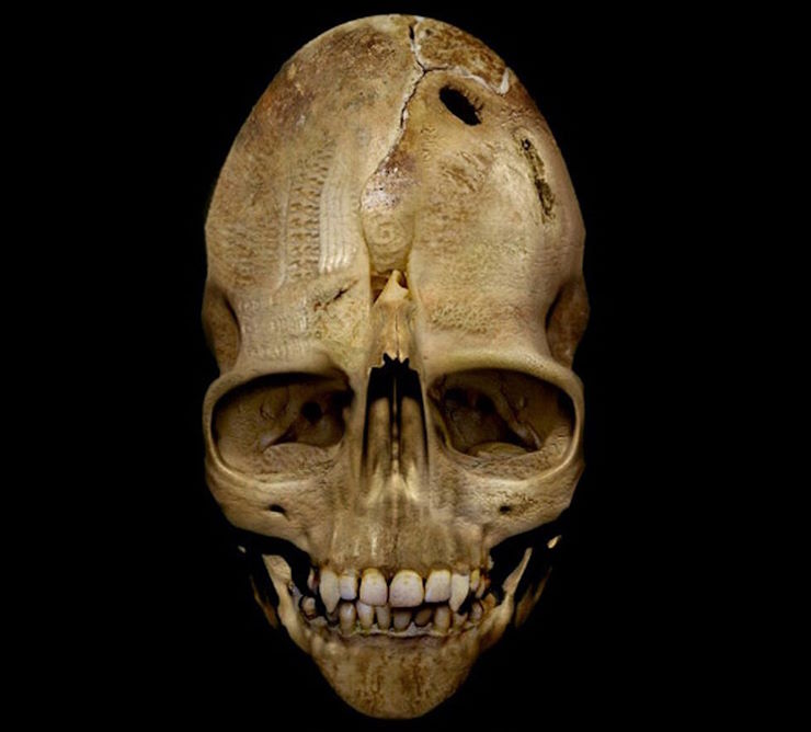 Андоверский череп принадлежал вампиру, неизвестному животному или инопланетянину?