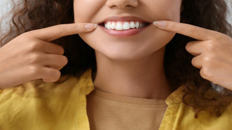 Отбеливание зубов: Как работает, виды и побочные эффекты