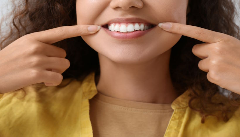 Отбеливание зубов: Как работает, виды и побочные эффекты