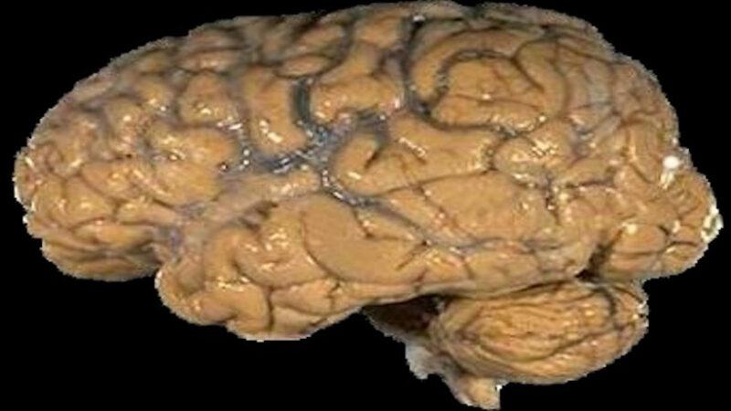 Ткань человеческого мозга выдерживает замораживание; нейроны возрождаются без повреждений, и новая техника может потенциально работать в крионик