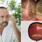 Свет надежды или пустая трата денег? Правда о терапии красным светом для роста волос